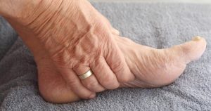 Accusoles cuanto cuesta, precio